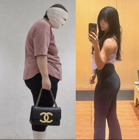 비포 애프터 변화